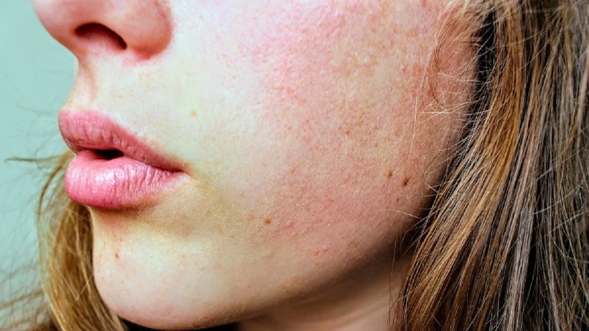 Dry Skincare Products Available Online: Simple Buyer’s Guide
